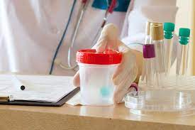 Yuk Periksakan Diri Ini Dia Biaya Cek Lab Prodia