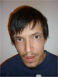 A de novo atypical ring sSMC(22) characterized by array CGH in a boy with  cat-eye syndrome