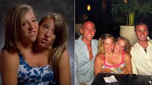Siamesas Abby y Brittany Hensel: ¿qué hacen hoy en 2023 tras la fama en la  TV?