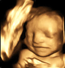 Profile for Picture Perfect 3D/4D Ultrasound Imaging