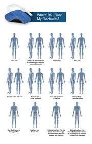 User avatar · wiki user. 9 Empi 300pv Ideas Tens Unit Placement Ten Unit Tens Electrodes