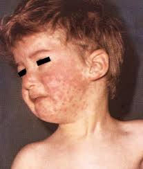 Public Health Preparedness News