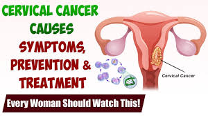 Pelvic or back pain is unexplainable. Cervical Cancer Causes Symptoms Prevention Treatment Cancer Dr Vipin Goel Health Tips Youtube