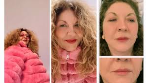 SMILES are trending this season: Injectors with a feminine touch!