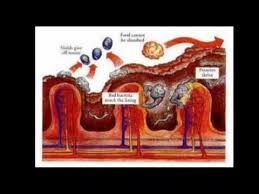 Pin On Food Grade Diatomaceous Earth Health Benefits Uses
