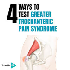 Image result for Resisted External Derotation Test