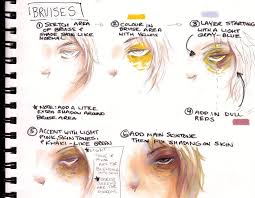 The blow bruised his arm. Tumblr Mubl2qlsvg1saiedgo1 1280 Jpg 1013 788 Body Drawing Bruises Pink Tone