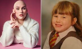 At 13, the stress of my parents' toxic divorce caused my hair to fall out.  It never grew back. This is what all divorcing couples need to know: LAURA  MATHIAS