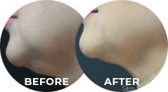 Ceo at skin perfect medical aesthetics. Top Medical Spa Los Angeles Orange County Skin Perfect Medical