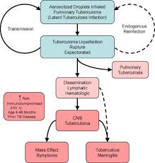 Uncommonly tuberculosis can be limited to the. Tuberculoma Of The Central Nervous System Journal Of Clinical Neuroscience