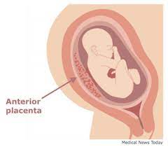 Placenta Positions And How They Impact Your Pregnancy And Birth Outcomes Baobag