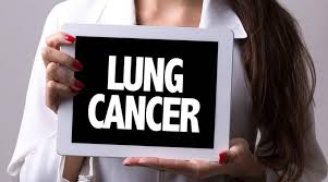 Generally, lung cancer doesn't show early signs. Lung Cancer Eight Signs You Need To Know Lifestyle News The Indian Express
