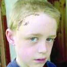 Boy's skull smashed for soccer game win