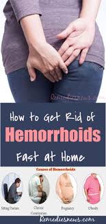 How To Get Rid Of Hemorrhoids Fast Try These Home Remedies Make Piles Go Away Fast At Home Extern Getting Rid Of Hemorrhoids Hemorrhoids Hemorrhoids Treatment