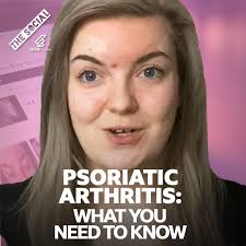 What is psoriatic arthritis? , Jude tells us how she's been affected, and  what helps her condition.