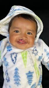 Fatima has been part of our program since her birth! Throughout the years,  she has participated in our milk program, undergone multiple surgeries,  received dental treatment, and is currently enrolled in our