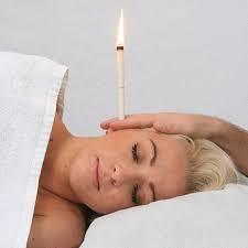 Dng Ear Candles Kit Ear Wax Remover Candles Ear Candling Aromatherapy For Blocked Ears Home Ear Candling Ear Wax Candle Ear Wax