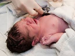 Preemie babies are susceptible to eye issues from oxygen use, head bleeds (and needing shunts or reservoirs), gut infections (ranging from stopping feeds for a dating babies is sometimes a funny thing. After Baby Is Born What To Expect Raising Children Network