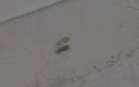 Petites Betes Miscroscopiques A L Aide