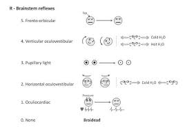 Image result for Oculovestibular Testing