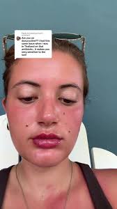 Replying to @Maddyyyfrost