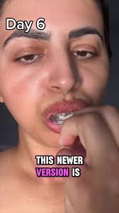 Natural Lip Enhancement that Actually Works