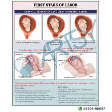 Image result for First Stage of Labor