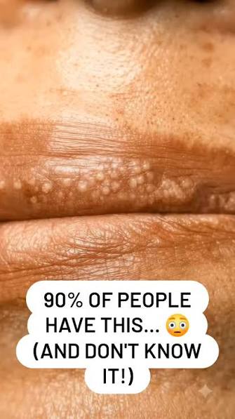 Why are my lips peeling? Comment "WOMBAT" for my free newsletter. On  Sundays, I share something about science & medicine with the occasional  health hack!