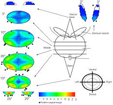 Prostate cancer symptoms might not be apparent in the early stages of the disease, and can be varied based on each person. Cmdx C Based Single Source Information System For Simplified Quality Management And Clinical Research In Prostate Cancer Bmc Medical Informatics And Decision Making Full Text
