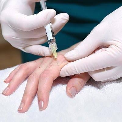 Hand Rejuvenation in Islamabad - F7