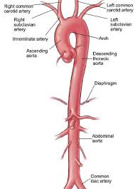 Thoracic Aortic Aneurysm Surgery Cleveland Clinic
