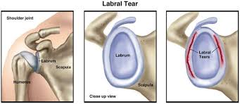 This diagram should be filed in google image search for , containing. Pin On Physical Therapies