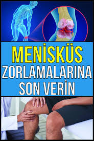 Meniskus Zorlamalarina Son Verin Dogal Tedaviler Saglik Saglikli Iliskiler