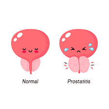 Benign Prostatic Hyperplasia Bph Enlarged Prostate Gauri Urogynecology Clinic