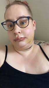 2005… in Soho 4 months after I got run over by an SUV that broke my face…  if u zoom in u can see the front of my jaw & my front