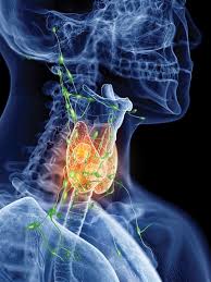 Symptoms of thyroid cancer the symptoms of thyroid cancer include a lump in your neck, a hoarse voice, a sore throat or difficulty in swallowing. Setting Limits Lymph Node Removal Thyroid Cancer Endocrine News