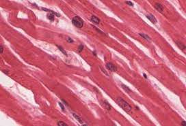 Helping White Men Lose Control Anatomy And Physiology Cardiac Muscle Cell Muscle Tissue