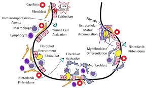 Frontiers Systemic Sclerosis Associated Interstitial Lung Disease New Directions In Disease Management Medicine