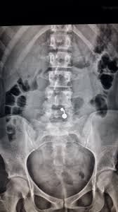 Pin On X Rays