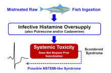 Image result for Scombroid Fish Poisoning