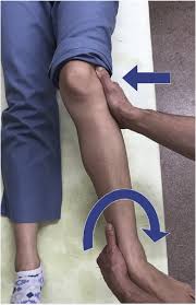 Image result for Ankle External Rotation Test