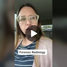 forensics #forensicradiology #radiology #medicalimaging #radiologicte...