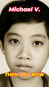 Michael Halim Before After