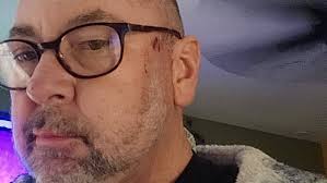 Fundraiser for Henry Erickson by Kerri Helliwell : Lifesaving Surgery for Henry  Erickson