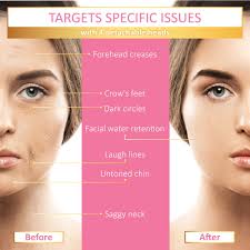 Dining table cover 4 seater round shape face forehead. Zodaca 4 In 1 Electric Vibrating Facial Roller Massager Kit 100 Rose Quartz Jade Roller Under Eye Press T Shape 3d V Face Lifting Beauty Bar Walmart Com Walmart Com