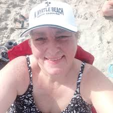 Does shrinking after amputation ever stop?