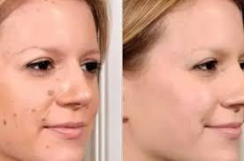 HAROLD KERSHAW, 80; OF WINDSOR LOCKS