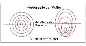 Bei mir schließt sich der muttermund nach der periode manchmal auch gar nicht komplett, sondern bleibt z.b. Muttermundslippe Mother Hood E V