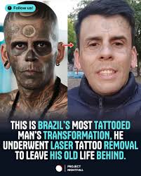 Once known as the most tattooed man in Brazil, Leandro de Souza had 95% of  his body covered with over 170 tattoos. His life was marked by struggles  with addiction, prison, and