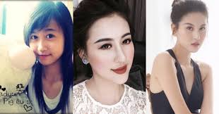 Dàn hot girl gần như "thay mặt” vì dao kéo: Bạn thân Huyền Baby suýt hoại  tử cằm, Ngân 98 mặt biến dạng